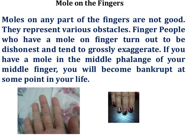 Different Moles On Meaning Body Parts Of Different Moles On Meaning Body Parts Of